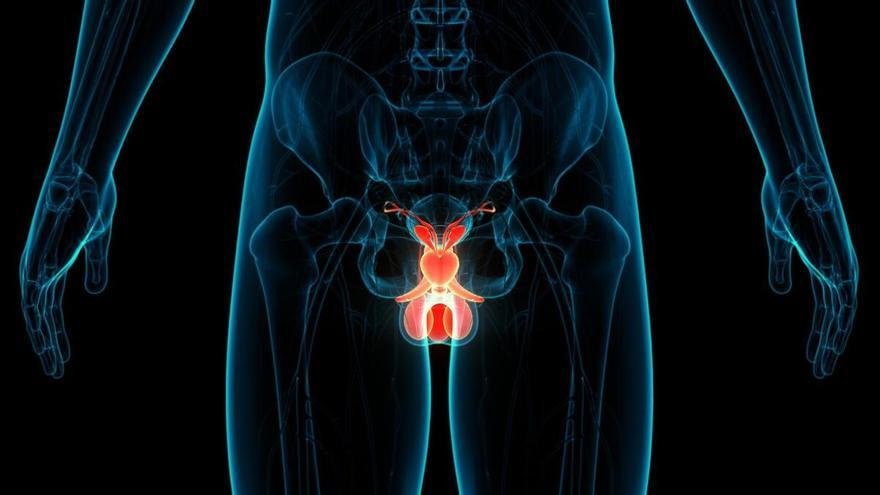 Próstata: Cómo descubrir que empiezan los problemas y cómo aliviar los síntomas