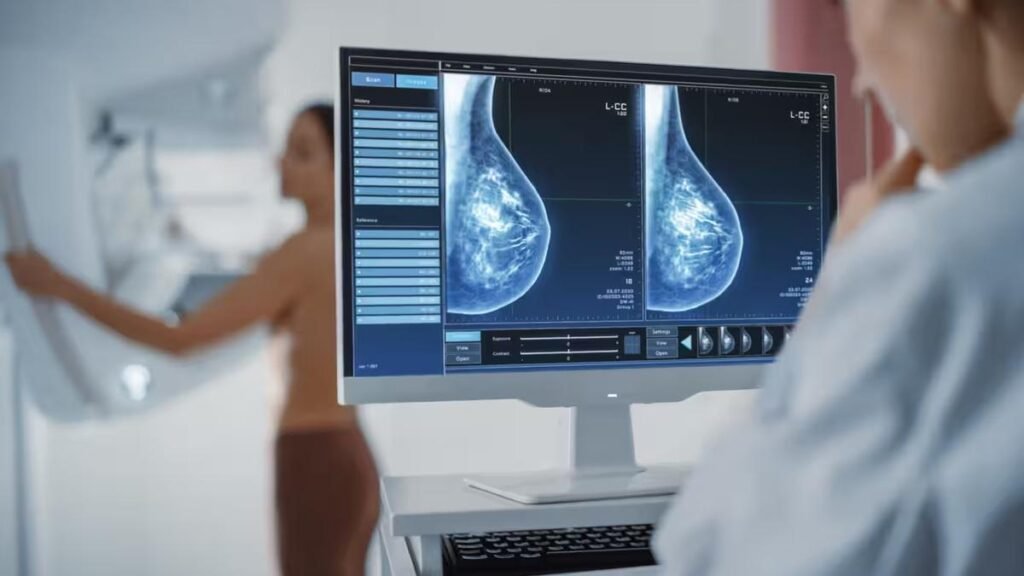 Mamografías antes de los 40 años: ¿por qué se recomienda bajar la edad del cribado de cáncer de mama?