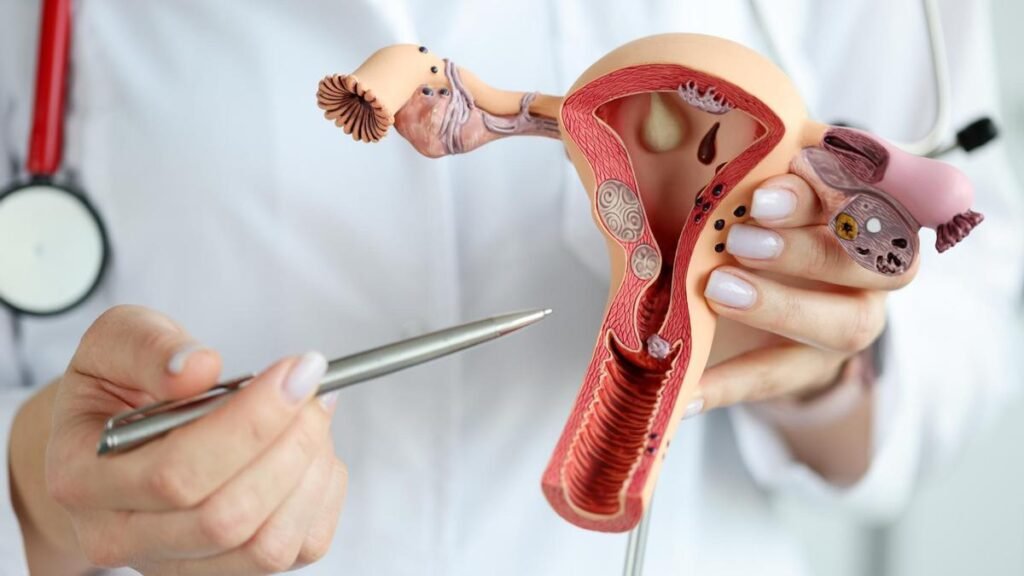 ¿Qué debemos de saber acerca del cáncer de ovarios?