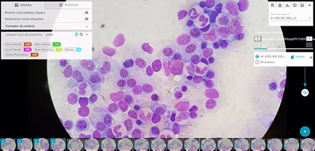 Investigadores diseñan un sistema que ayudará a diagnosticar enfermedades hematológicas de forma más rápida y precisa