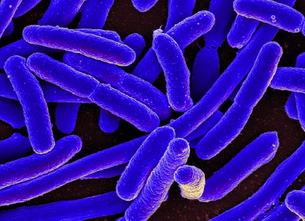 Unas 4.000 personas mueren anualmente en España por las bacterias multirresistentes