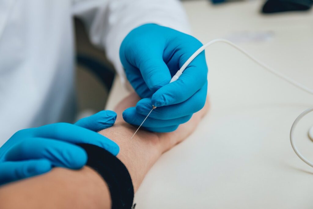 ¿Es dolorosa la electromiografía? Todo lo que debes saber sobre este procedimiento